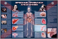 Электрифицированный стенд "Вредные привычки: алкоголизм" - «globural.ru» - Краснокаменск